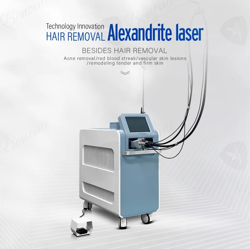 Alexandrite laser