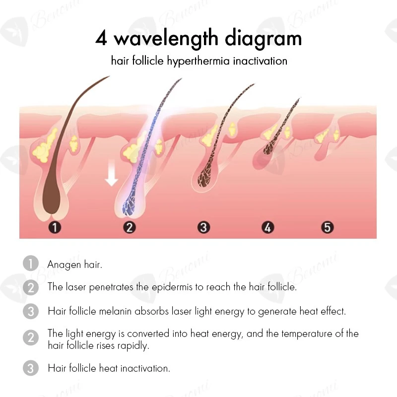 4 Wavelength Diode Laser 4 Wavelength Diode Laser